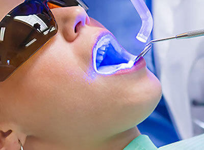 Advanced San Francisco Dentist Teeth Whitenting