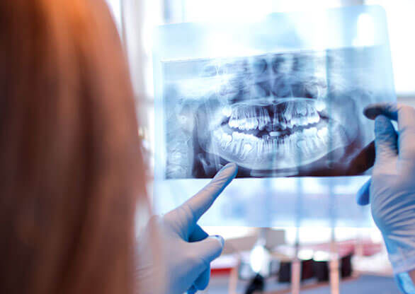 Dentist San Francisco X Ray Photo